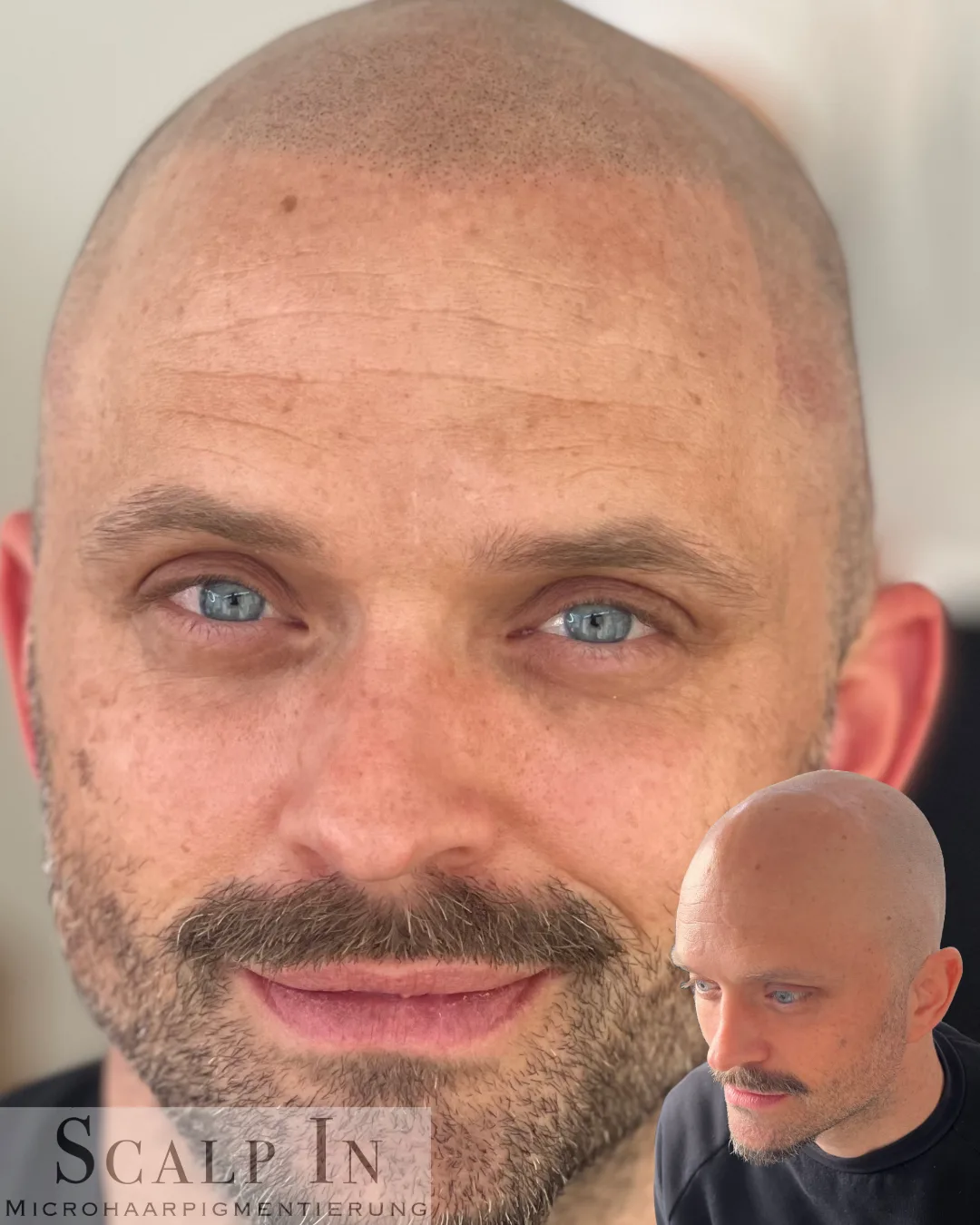 Ergebnis 8